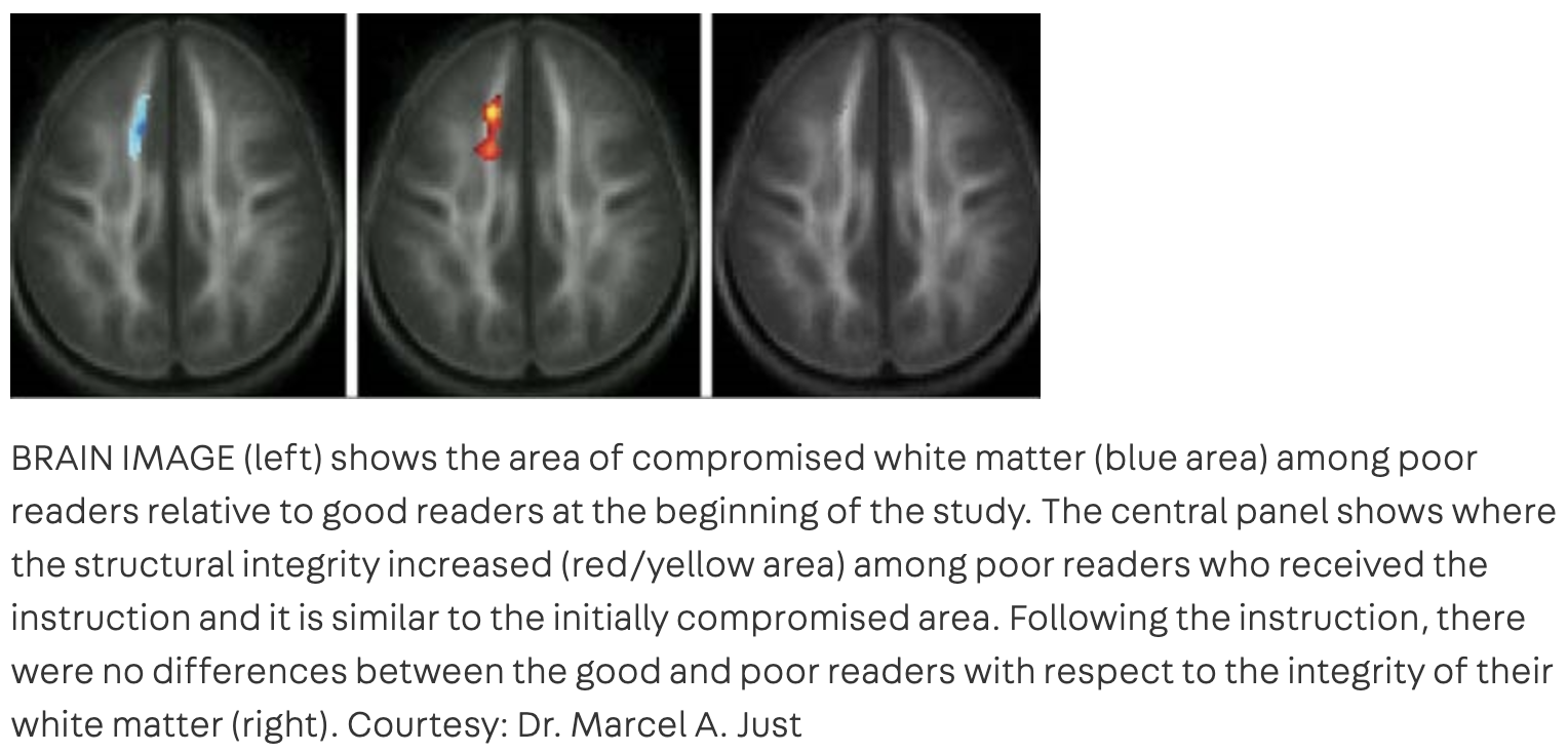 Study Results for Reading Remediation